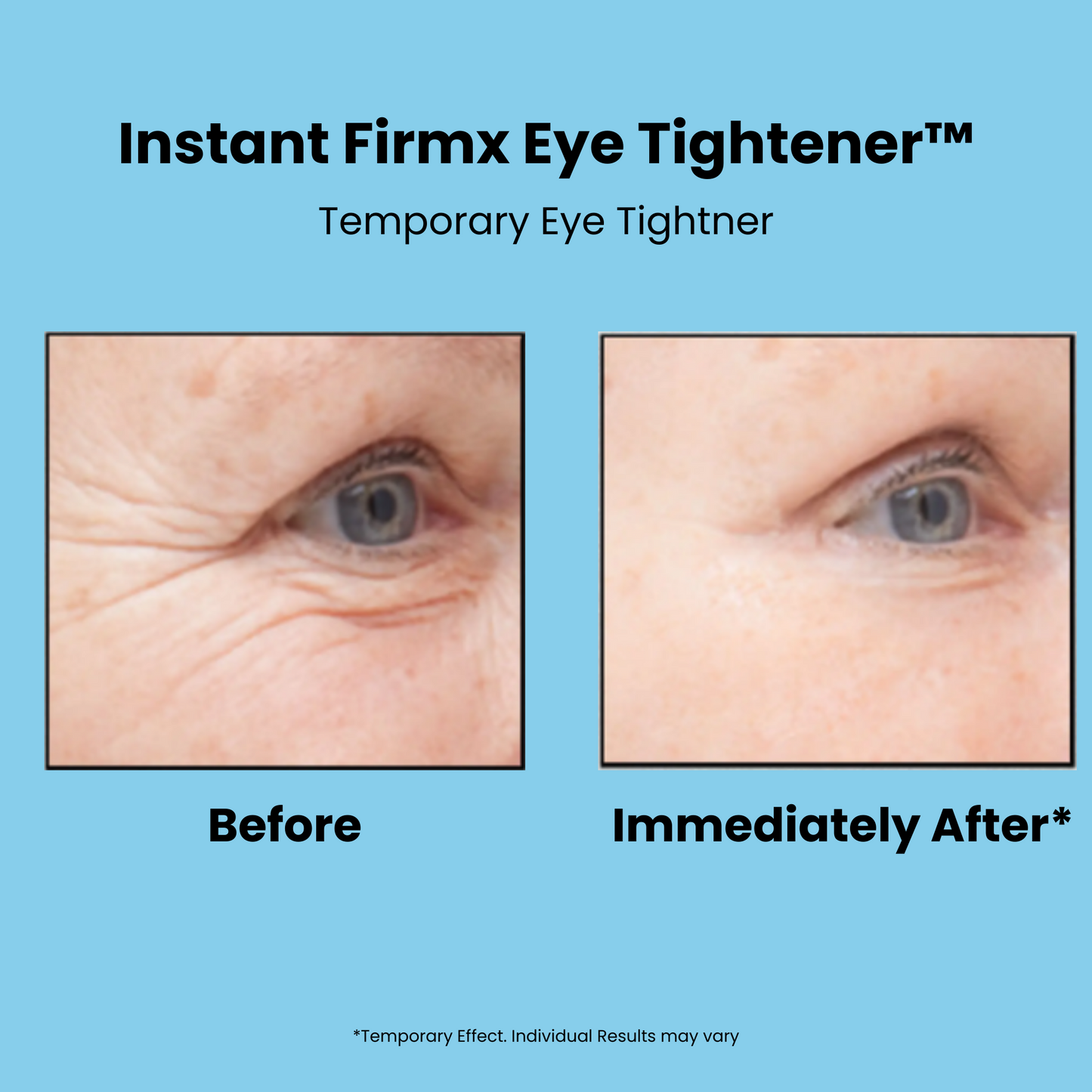 The Instant Firmx Eye Tightner
